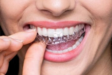 Los alineadores invisibles marcan el comienzo de una nueva era dental